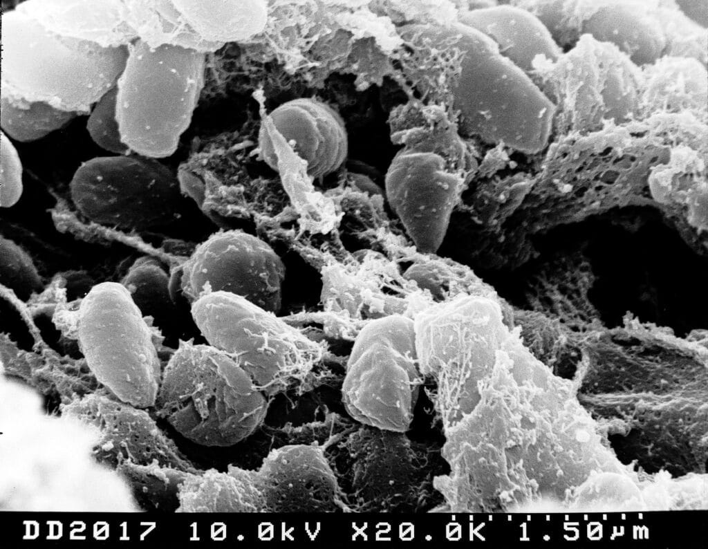Scanning electron micrograph showing Yersinia pestis bacteria inside a flea’s digestive tract.