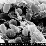 Scanning electron micrograph showing Yersinia pestis bacteria inside a flea’s digestive tract.