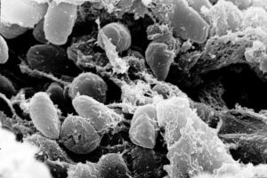 Scanning electron micrograph showing Yersinia pestis bacteria inside a flea’s digestive tract.